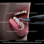 پولیش وودپیکر مدل polish-h - Image 5