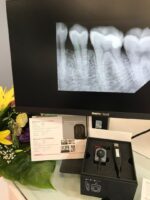 RVG مدل Vatech ez sensor کلاسیک