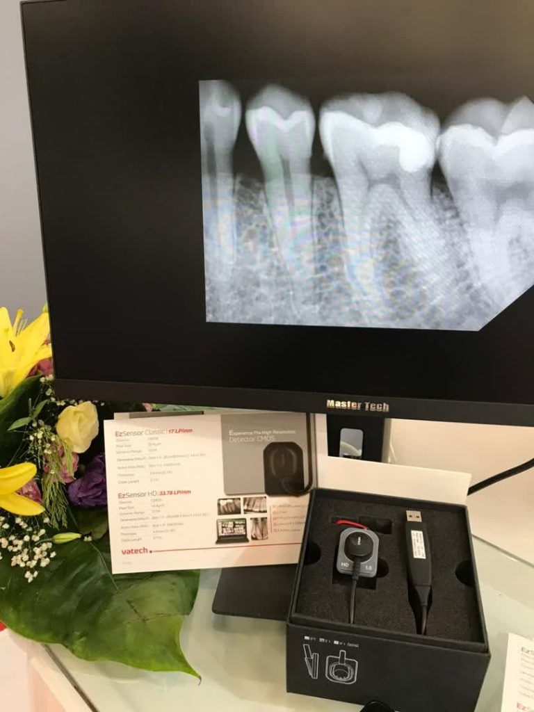 RVG مدل Vatech ez sensor کلاسیک