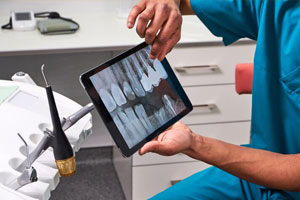 اپکس فایندر