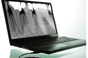 سنسور آر وی جی