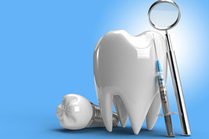 موتور ایمپلنت