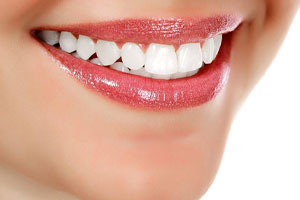 بهترین سفید کننده دندان